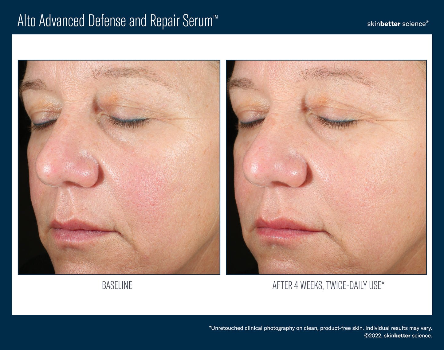 SkinBetter Science Alto Advanced Defense and Repair Serum 30ml